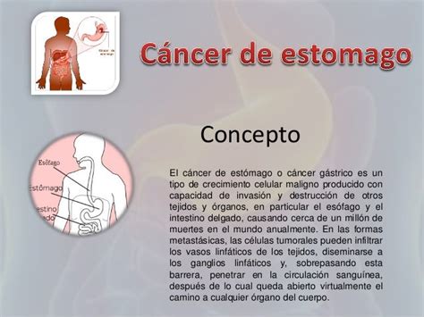 Cancer de estomago