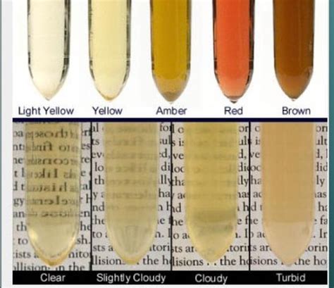 Urinalysis Week 2 Flashcards Quizlet