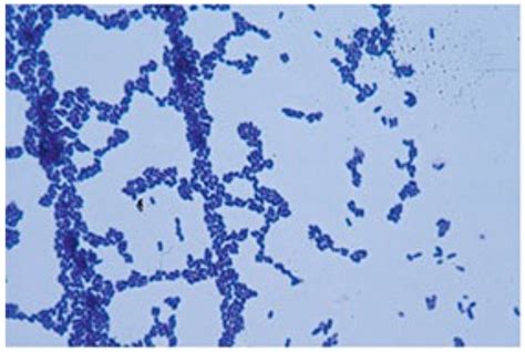 Corynebacterium Diphtheriae Colony Morphology