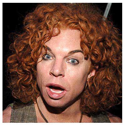 Plastic Surgery Before And After: Carrot Top Plastic Surgery