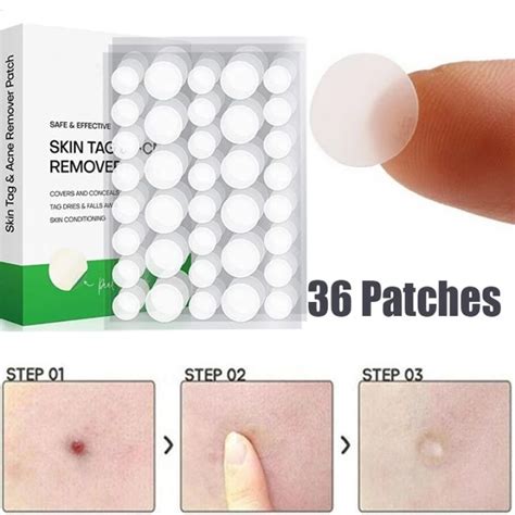 36Pcs Acne Wart Remover Patches Hydrocolloid Gel Anti Infection