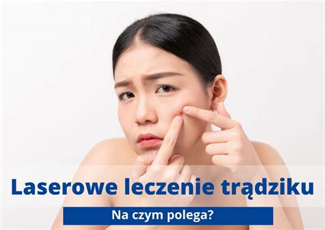 Laserowe Leczenie Tr Dziku Na Czym Polega T Umaczy Lasermed