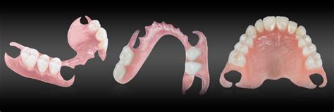 Flexi Dentures Carntyne Dental Care