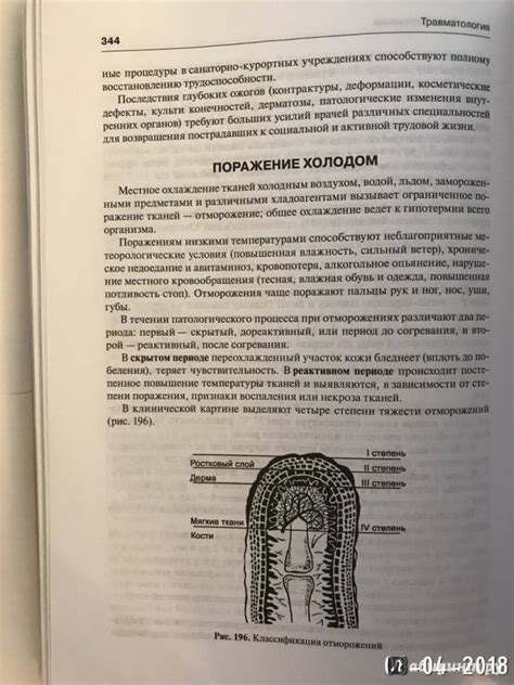 Книга: Травматология и ортопедия. Учебник - Корнилов, Грязнухин, Шапиро ...