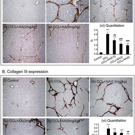 Immunohistochemistry Detects That Aa Treatment Attenuates Ccl 4 Induced