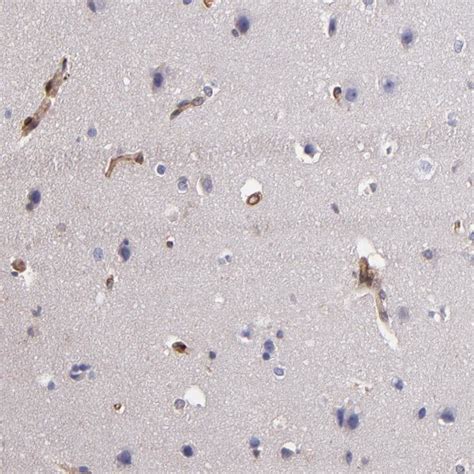 Vinculin Antibody (PA5-82003)