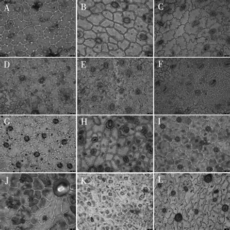 Scanning Electron Microscope Photographs Of Epidermal Cells In