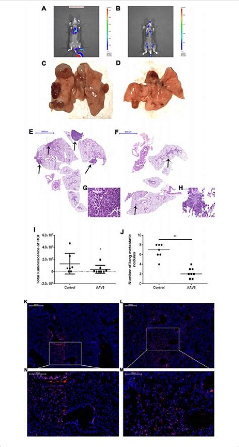 Enforced Expression Of Kr Ppel Like Factor Klf In The Lung