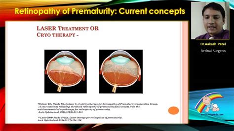 Retinopathy Of Prematurity Laser