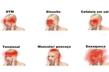 Sinais De Que Suas Dores De Cabe A S O Perigosas Tipos De Dor De