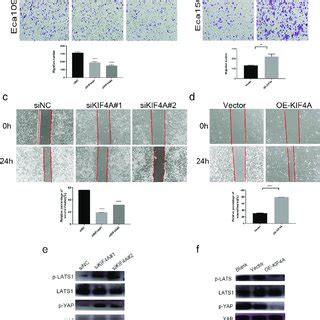 Kif A Promotes Proliferation Of Esophageal Squamous Cell Carcinoma