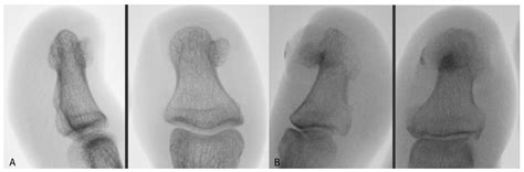 Jcm Free Full Text The Influence Of Clinical Factors On Treatment