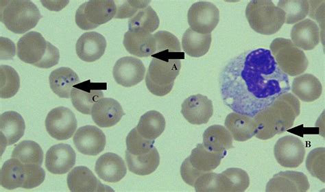 Protozoa And Endocrine Dysfunction Endotext Ncbi Bookshelf