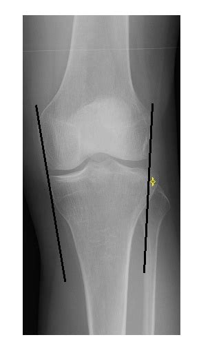 Imaging Case Of The Week 241 Answer Emergucate