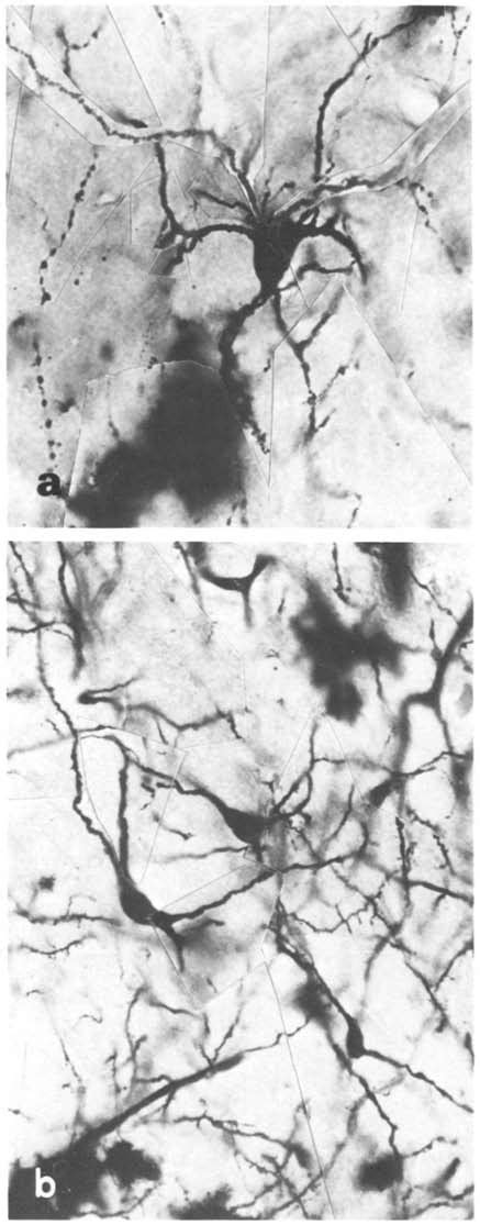 A B Mammillary Region Of The Japanese Quail Golgi Impregnation