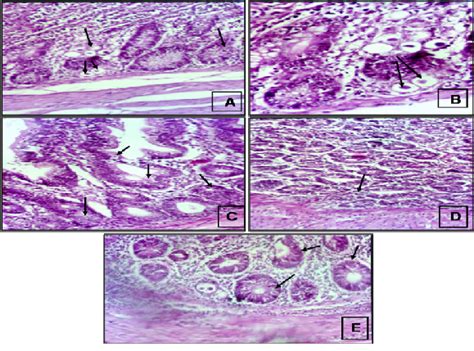 Caecal Sections Of Chicken Infected With Oocysts Uspected To Be E