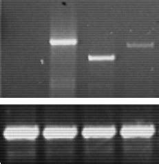 Gene Expression Of Human Wildtype Plasminogen Wtplg Angiostatin