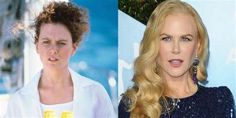 Nicole Kidman Before And After – Telegraph