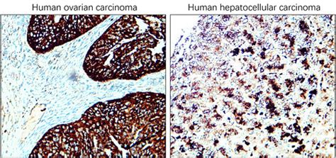 Exosome Marker Antibody Panel Irap Ireal Biotechnology Inc