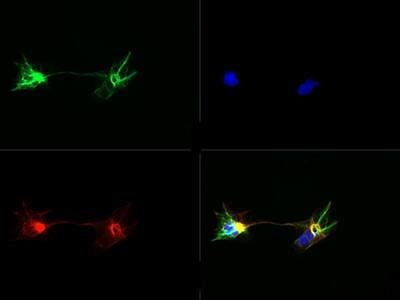 Deriving Neural Precursor Cells From Human Induced Pluripotent Stem