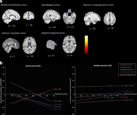 Connectivity Analyses With The Right Dorsolateral Prefrontal Cortex