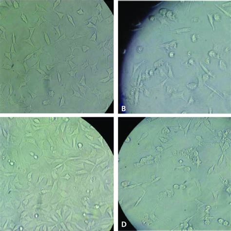 Morphology Of Mcf 7 A B And L929 C D Cells Abefore And After Download Scientific Diagram