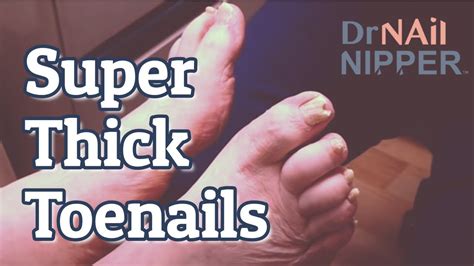 How To Trim Thick Diabetic Toenails Is This An Actor Just Listen To