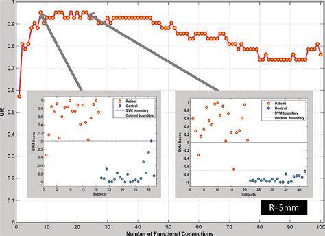 Figure 1 From Mesial Temporal Lobe Epilepsy Lateralization Of