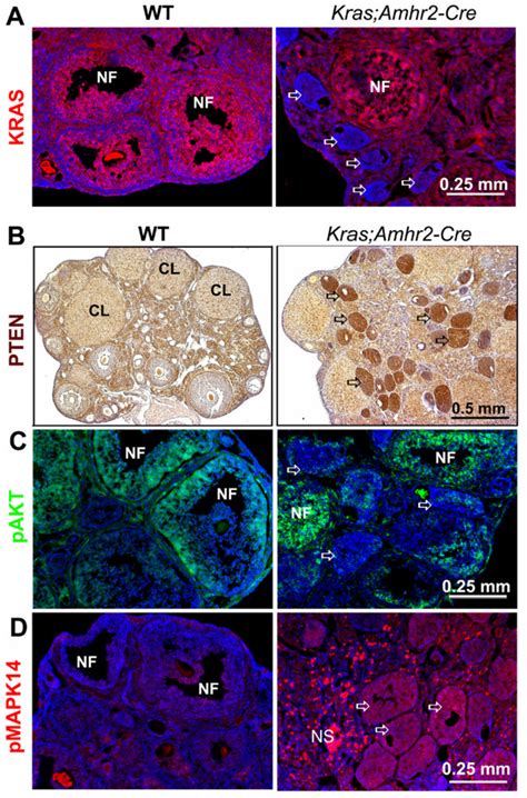 Kras G12d Down Regulates Kras And Up Regulates Pten In The