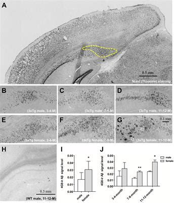 Frontiers Sex differences in hippocampal β amyloid accumulation in