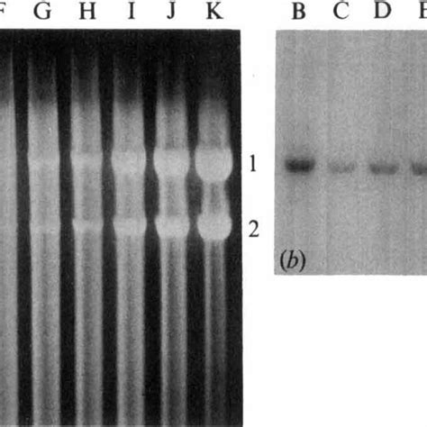 Determination Of Plasmid Copy Number By Agarose Gel Electrophoresis A