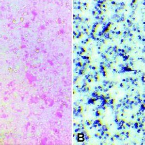 Mycelial Colonies Of H Capsulatum Showing White Aerial Hyphae At