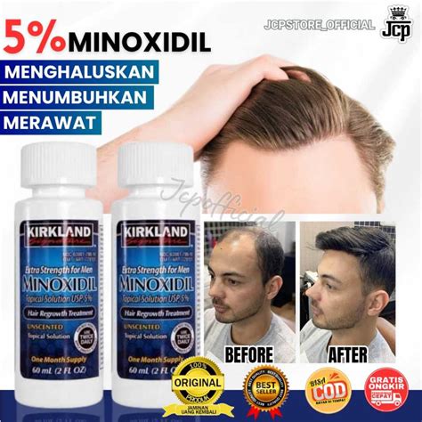 Jual KIRKLAND MINOXIDIL 5 EXTRA STRENGTH 60ML PENUMBUH RAMBUT PRIA