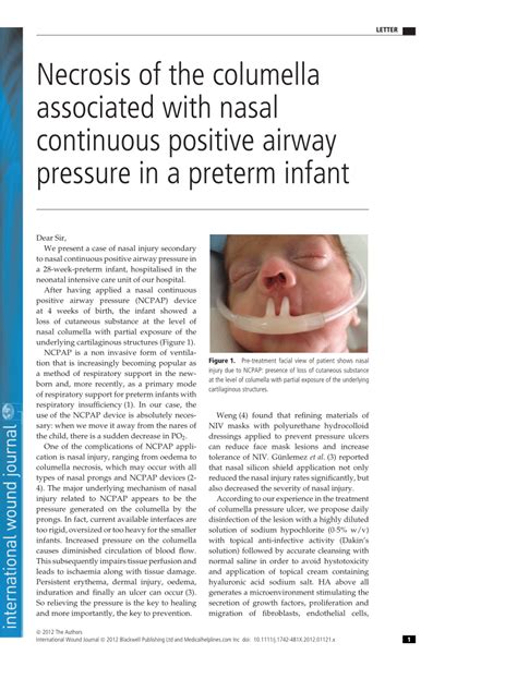 Pdf Necrosis Of The Columella Associated With Nasal Continuous