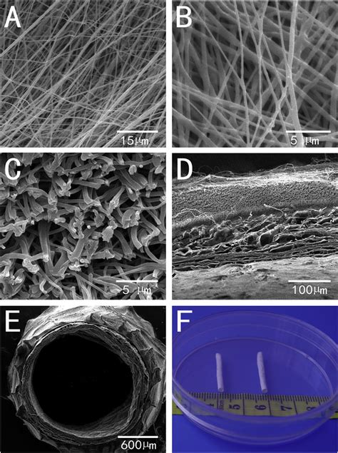 Structure Characterization Of Electrospun Pcl Hybrid Vascular Grafts