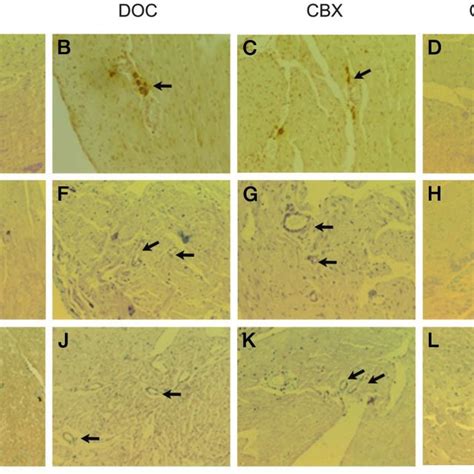 Representative Photographs Of Immunohistochemical Staining For Ed