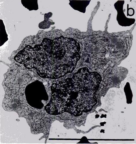 Transmission Electron Microscopy Of The Phagocytosis Process Bars 10 Download Scientific