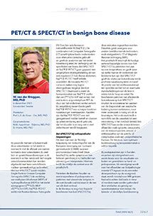 Mrt Pet Ct Spect Ct In Benign Bone Disease Tijdschrift Voor