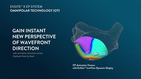 Abbott Cardiovascular On Twitter Announcing Ensitex Software Version