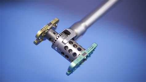 obelisc™ – Expandable vertebral body replacement