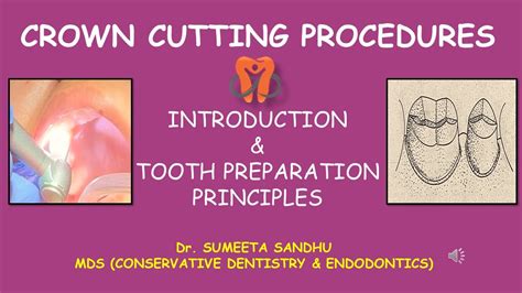 Crown Cutting Procedures Introduction Youtube