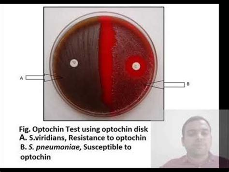 OPTOCHIN SENSITIVITY TEST YouTube