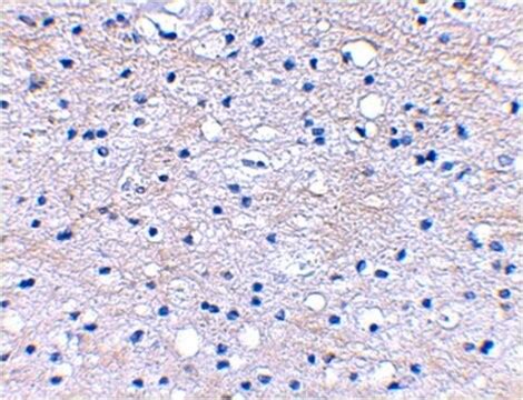 Anti Bral Antibody From Rabbit Purified By Affinity Chromatography