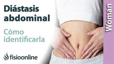 Cómo SABER si tengo DIÁSTASIS ABDOMINAL tras el embarazo y parto YouTube