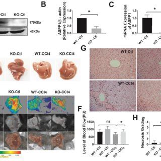 Ablation Of ASPP1 Alleviates CCl4 Induced Acute Liver Injury In