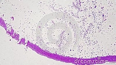 Escherichia Coli Smear Under Microscope 200x Scientific Slide on Bright ...