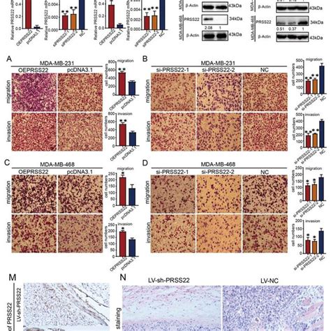 Prss Promotes Breast Cancer Cells Migration And Invasion Abilities