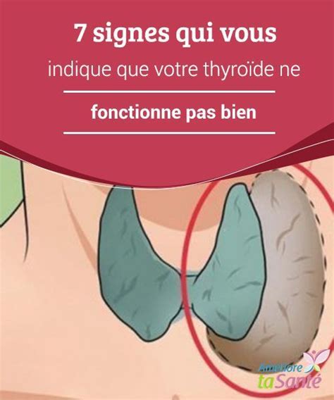 problème de thyroïde symptômes