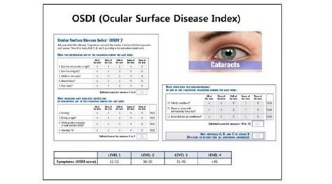 Cataract Cataract Surgery Cataracts Ocular Surface Disease Index Osdi