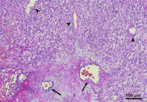 High Power Field Image With Hematoxylin And Eosin Stain Showing Newly